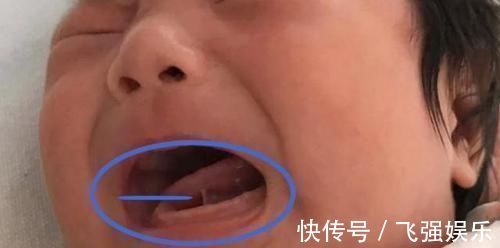 家长|宝宝1岁不会说话,奶奶拿剪刀要“剪舌根”,医生:回去吧治不了