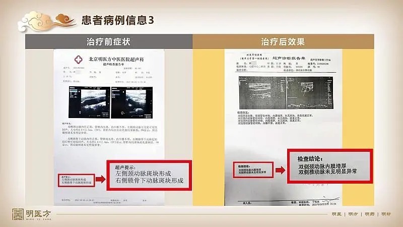 防寒|秋去冬来,别着急养生,这才是最要命的