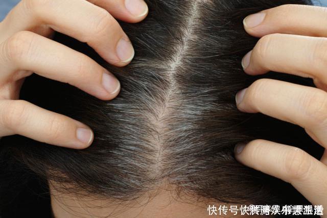 肝病|肝病都是拖出来的,一旦晨起有4个表现,是肝在“求救”,别大意