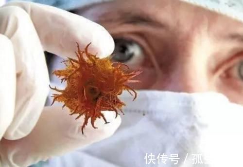 主任|癌症晚期还可以活多久？医院主任：说了3句“大实话”！