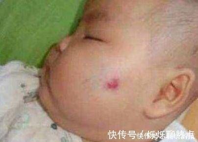 胎记|怀孕期间,经常做这两件事的孕妈,胎儿容易长胎记,后悔都来不及