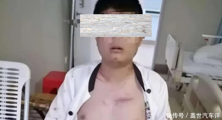 十多人|湖南男子买到发霉食品去更换,反遭十多人围殴,打断12根肋骨