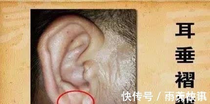 偏高|血脂偏高的人,头部或有4个表现,若想调节血脂,给你2个小建议