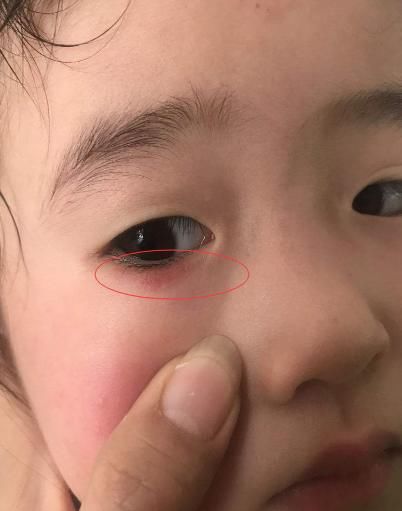 黄小米|孩子积食反复,建议少碰“2红”,多食“2黄”,消化好不积食