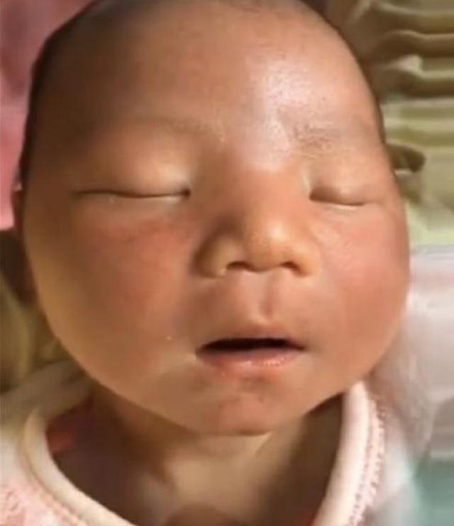 逆袭|90后宝妈生下“包公”宝宝，亲戚们都说丑，三个月后实现“逆袭”