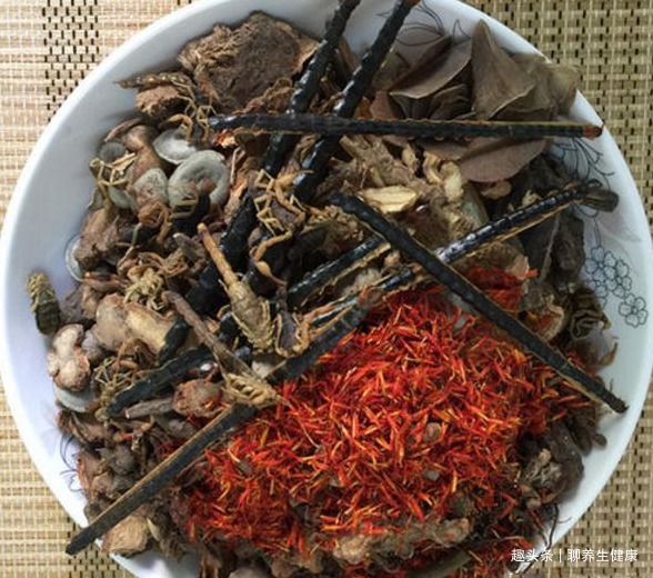 腰腿|一个千古止痛名方,6味药,腰不突了,腿不痛了,老风湿也拜拜了