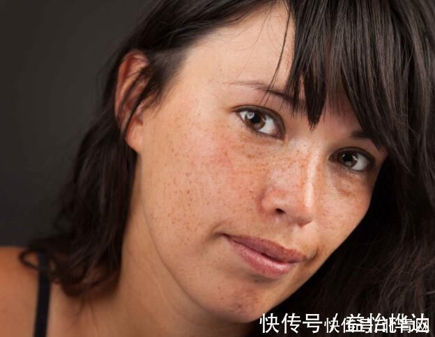 皮肤|皮肤出现4种症状,或是肝出问题了,趁早查一下