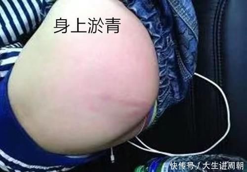 孩子|四岁女孩身上常有淤青，父母查幼儿园监控，得知罪魁祸首后很羞愧