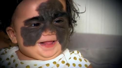 不想让宝宝有胎记？孕妈3种行为有关系，怀孕后不要太任性