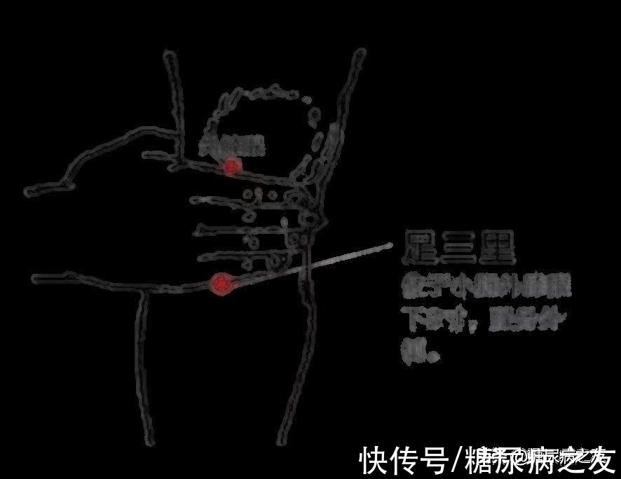 麻木|给大家推荐一种可以改善下肢麻木、酸痛的按摩方法，亲测有效