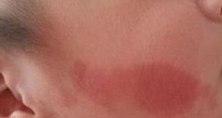 女性|女性怀孕后,几件事孕妇最好不要干,要不然出生的婴儿可能有胎记