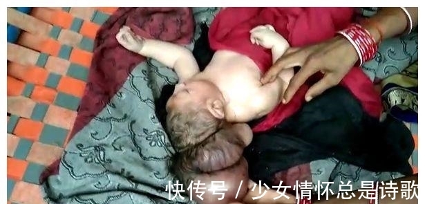 女子|印度女子产下“3头婴儿”,当地人认为是“上帝的化身”