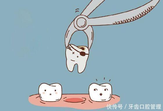 蛀牙|预防孩子龋齿不止是控制吃糖