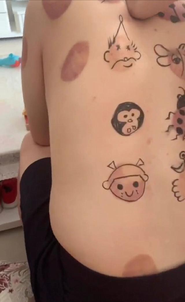 妞妞|爸爸拔完火罐回到家,下一秒女儿的这一举动,网友直呼:太有才