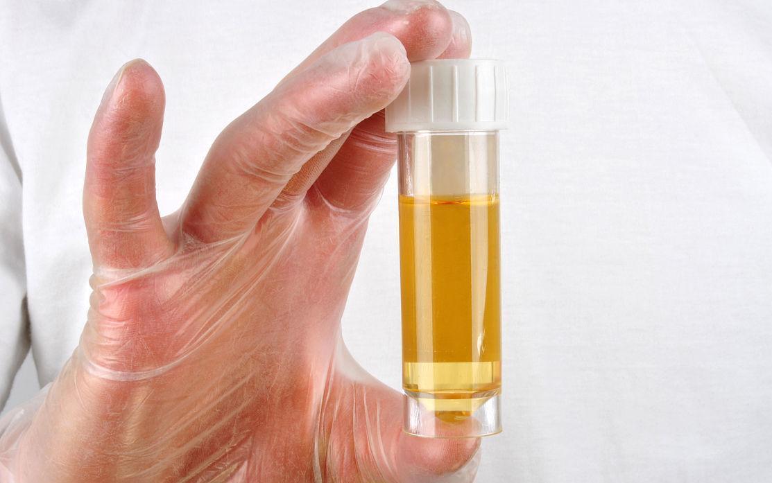 尿酸|难怪尿酸高居不下,有“1物”比猪肉嘌呤高42倍,很多人仍然在吃