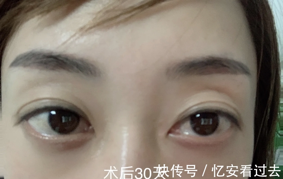 项目|别以为秒杀的医美项目是赚到!