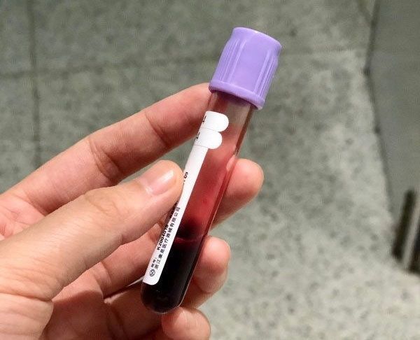 攻略|怀孕多久做B超检查比较好?这份孕早期检查攻略,孕妈们查收学习