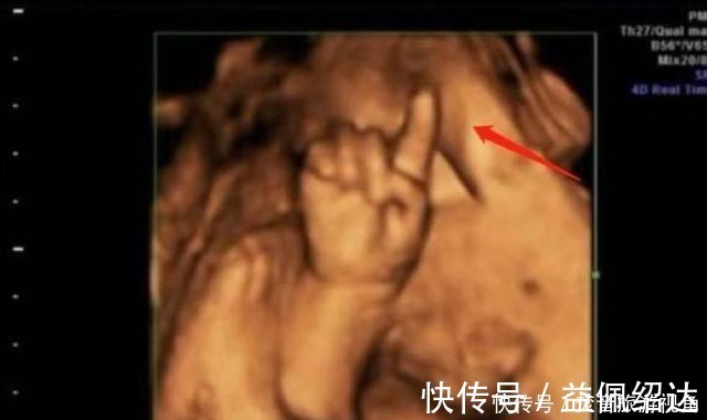 检查|“天才”胎儿走红,还在妈妈肚里就会“算数”,医生清华北大等你