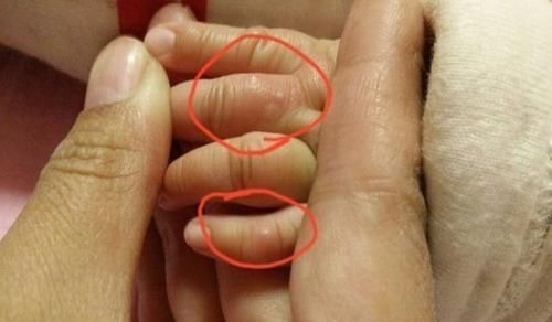 灵活度|孩子聪明不聪明,从手上就能看出来,智商的高低就“写”在手上