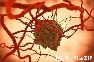 碱性|碱性体质的人，离癌症很远！7类食物都属于碱性，为健康多吃