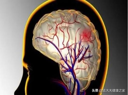 此文|老年人预防脑梗与老年痴呆，如何补充叶酸与B12很重要，请看此文