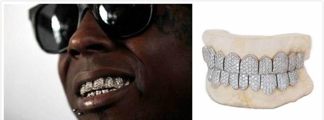 潮流|富商钻石牙惹来痛苦,牙钻潮流,玛雅人早玩过了