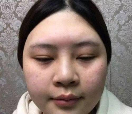 3种被公认为“不忍直视”的脸型，神仙整容术也拯救不了你的颜值