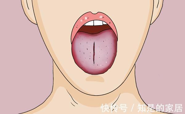 不良习惯|舌苔白厚、肚子隐痛，是哪种湿气重？有什么调理的好方法？