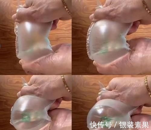 弹性|“毁容式”怀孕之妊娠纹:10个孕妈9个长纹,教你咋应对咋预防