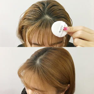 谁说“秃头”没办法改善?教你这5招小秘诀,轻松拯救你的发际线