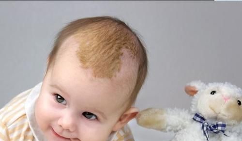 宝妈|你家宝宝头上有舅舅屎吗?这样处理不伤头皮,赶紧get起来