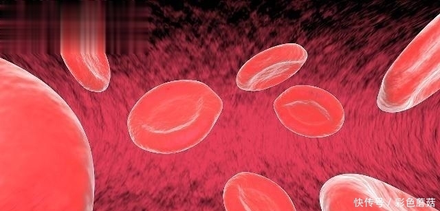 焕然一新|绝大多数“血栓”都无迹象,要想预防,记住一个字,血管焕然一新