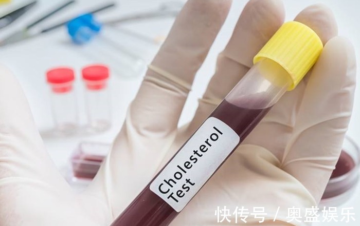 血脂|高血脂不能吃鸡蛋,尤其鸡蛋黄医生辟谣和鸡蛋没有半毛钱关系