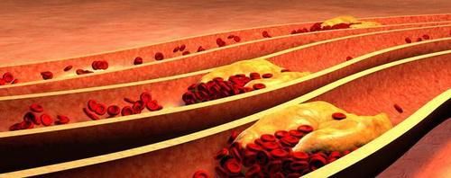 稳定|高血脂的人,在这3个时间段喝水,能稳定血脂水平,是哪3个?