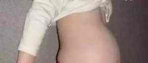 检查|4岁小女孩肚子大的好像孕妇一样,经检查后父母痛心不已