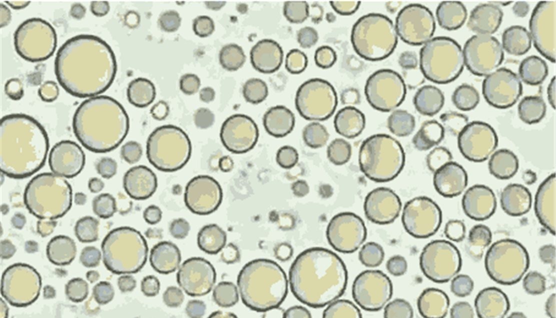 白细胞|将母乳放大1000倍是什么样显微镜下的图片,当妈的都该看看