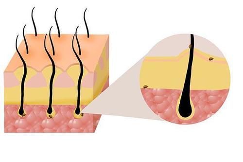 一挠头皮，指甲缝中都是白泥？医生：可能不是头皮屑，要上点心
