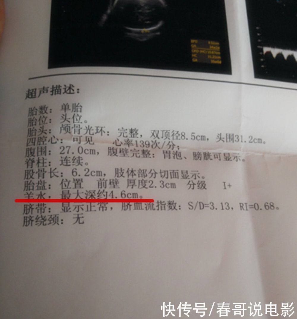 产妇|孕晚期最后一次产检，产妇要问清楚医生三件事，关乎能否顺利分娩