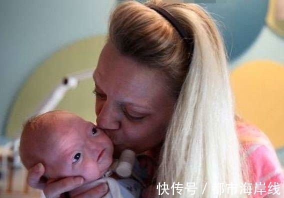 长大|婴儿出生就没有鼻子,父母觉得很可爱,孩子长大后再决定是否手术