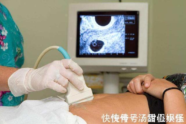 小方|孕妈喜怀“双胞胎”,产检时医生摇头两次受孕怀上的,并非好事