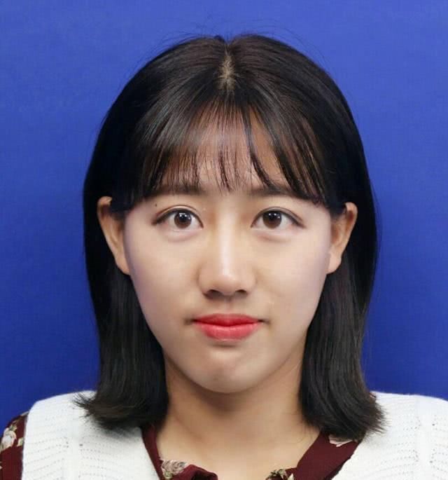 假体|女生整容会被嫌弃吗只要没有这几点,整过之后还是很漂亮