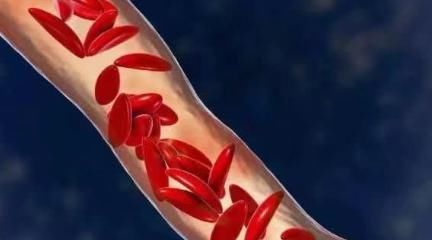 超标|甘油三酯超标的人怎么办?几种食物要多吃,可软化血管净降血脂