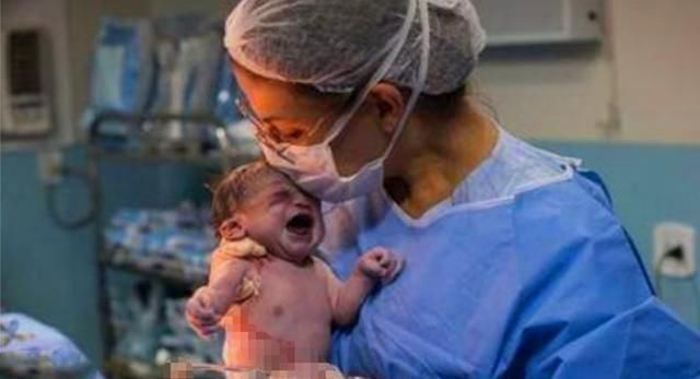 弄出来|“就是你把我弄出来的”宝宝出生时脸太臭,医生都被盯毛了