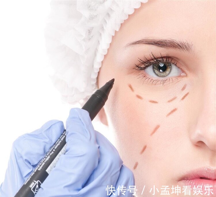 大卫·米勒德|为什么劝女人不要割“双眼皮”?主要有这5个原因,庆幸没跟风