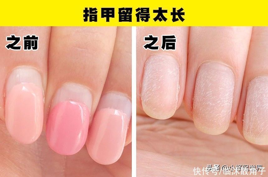 指甲油|在日常生活中,可能会对指甲产生破坏的7种习惯