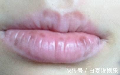 黄褐斑|子宫不好的女人,脸上会有4个“呼救”,要留意