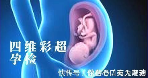 胎儿|孕妈深受这三项检查的折磨，忙碌的准爸爸，最好与孕妈一起