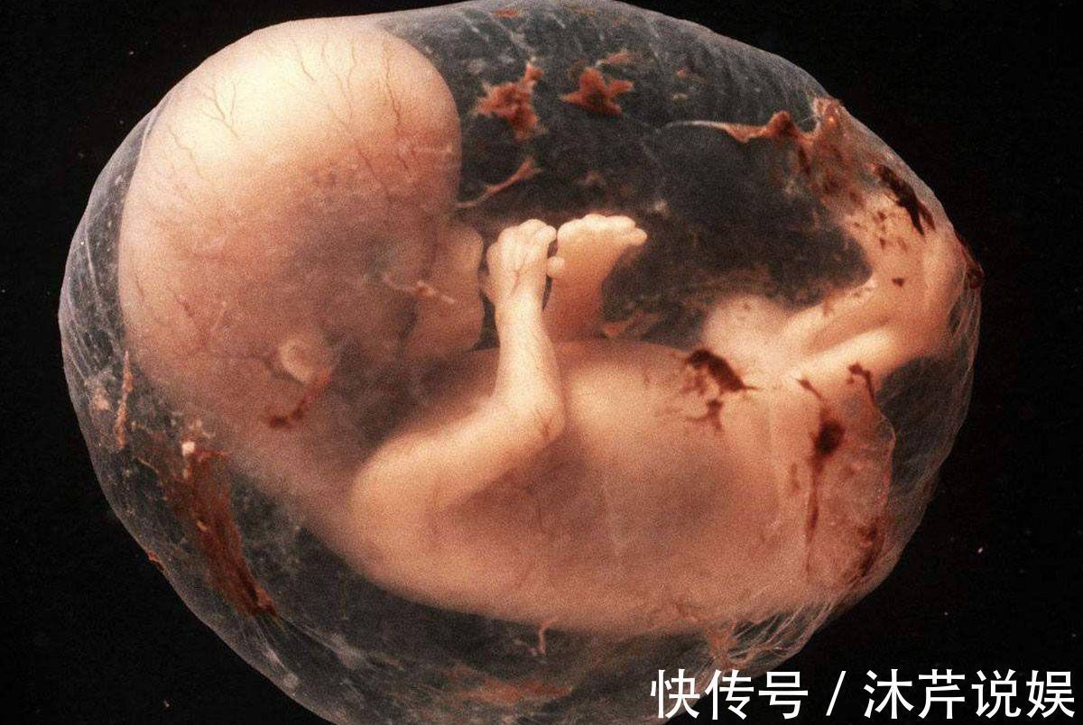 尿液|胎儿在母亲肚子里,生活的很“精致”!不过他的大小便都去哪了