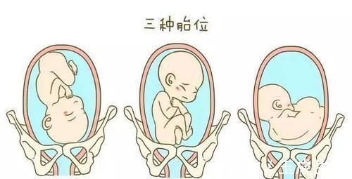 杨院长|女人可以做几次剖腹产不是三次和五次,医生不要超过这个数