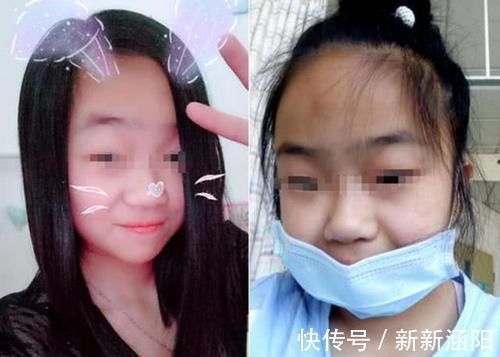 小老头|这5种孩子会越长越丑,长大也难逃开“变丑”结局,你家娃中了吗